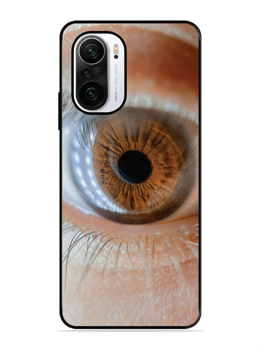 XIAOMI MI 11X 5G Eye