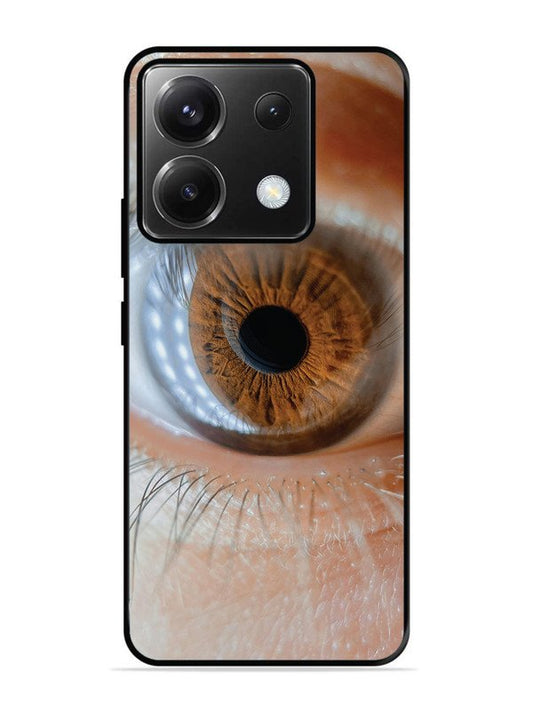 Xiaomi Redmi Note 13 Pro 5G Eye